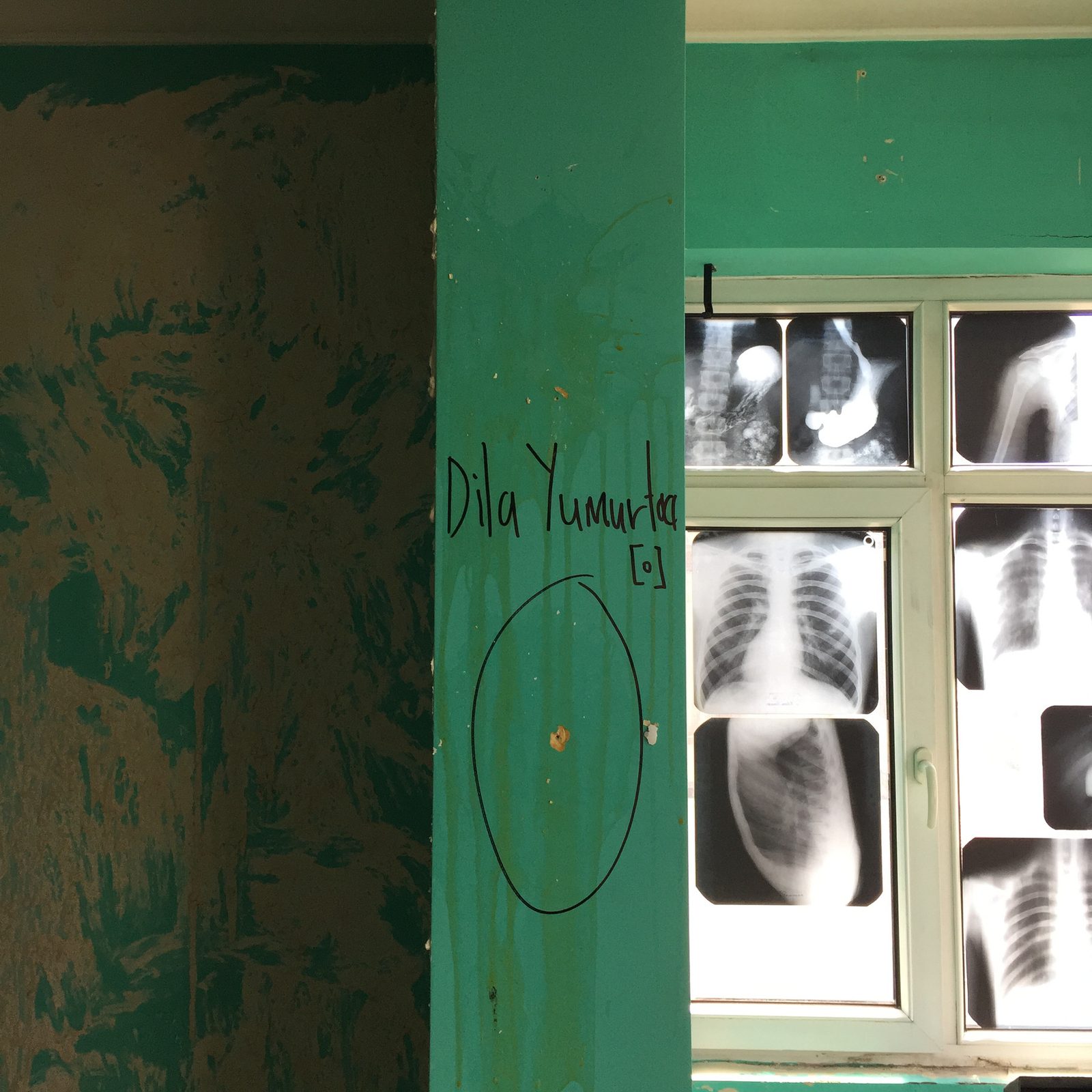 Green painted wall with the name Dila Yumurtacı circled, X-ray films taped over a window
